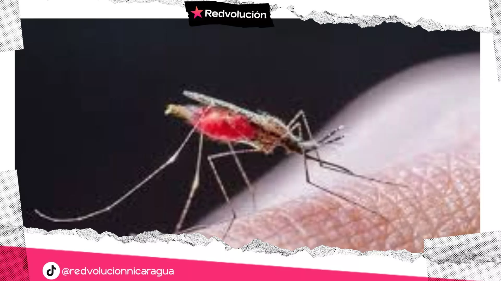 MINSA reporta disminución del 33% en los casos de Malaria durante la última semana