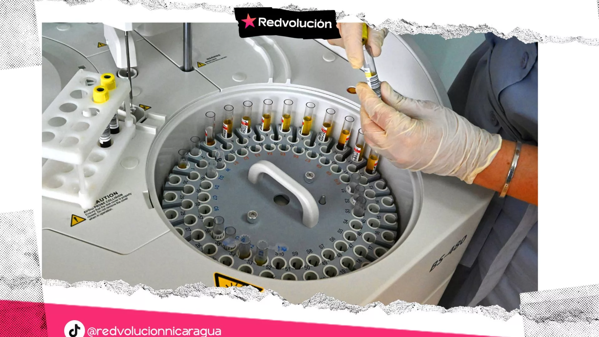 La innovadora vacuna rusa contra el cáncer está lista para su uso clínico